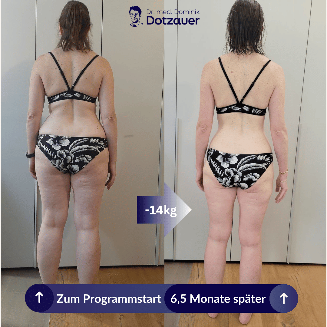 Vorher-Nachher-Vergleich einer Programmteilnahme: 14 kg weniger